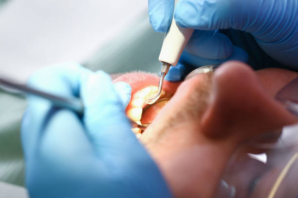 Best Emergency Tooth Extraction in Prairie City, IA